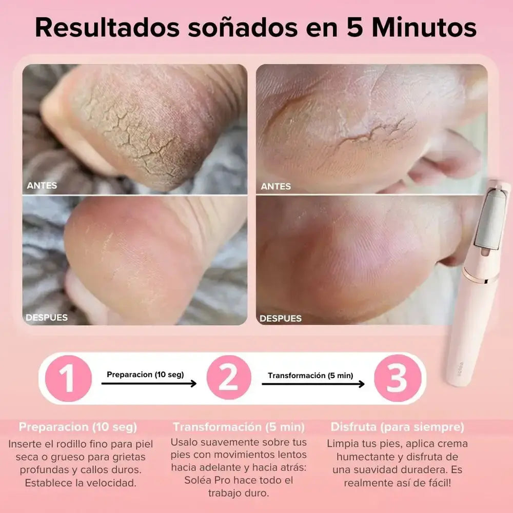 DermoFoot™ — ¡Pies Suaves en Minutos! + Ebook Exclusivo para Pies de Ensueño
