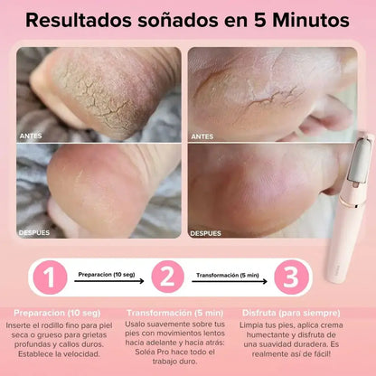 DermoFoot™ — ¡Pies Suaves en Minutos! + Ebook Exclusivo para Pies de Ensueño